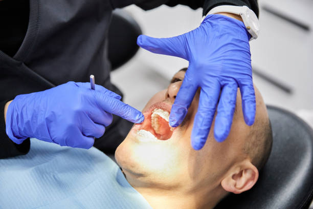 Best Teeth Whitening  in Butte, AK